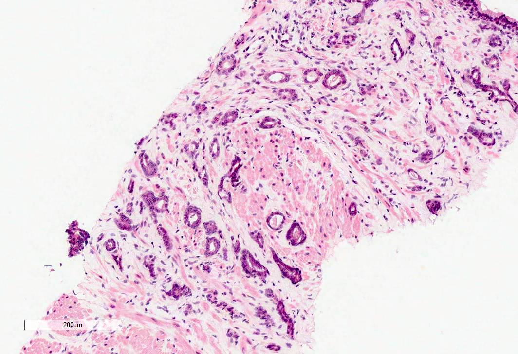 prostate pathology outlines