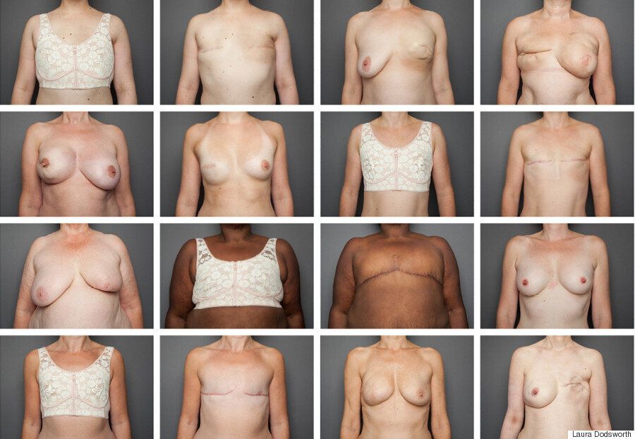 bare reality 100 women their breasts their stories