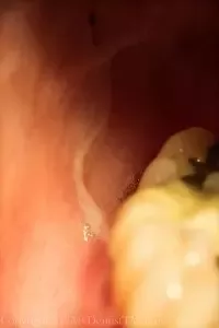 oral b toothpaste leaves film in mouth