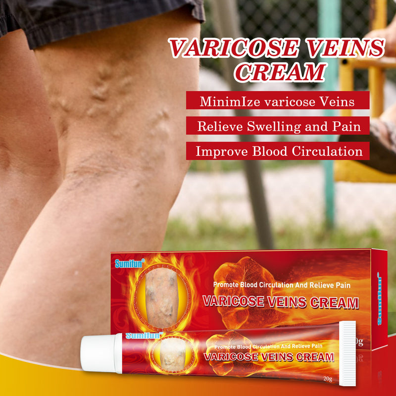 varicose veins relief cream reviews