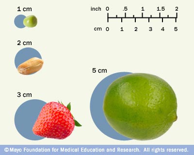 5.4 cm to inches