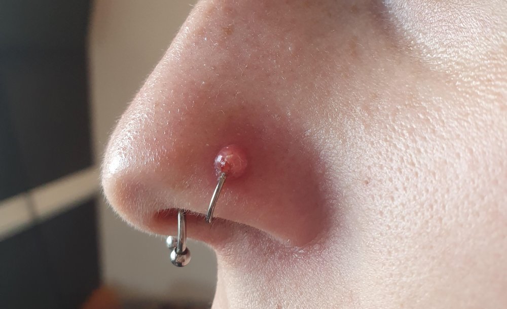 how to get rid of nose ring infection