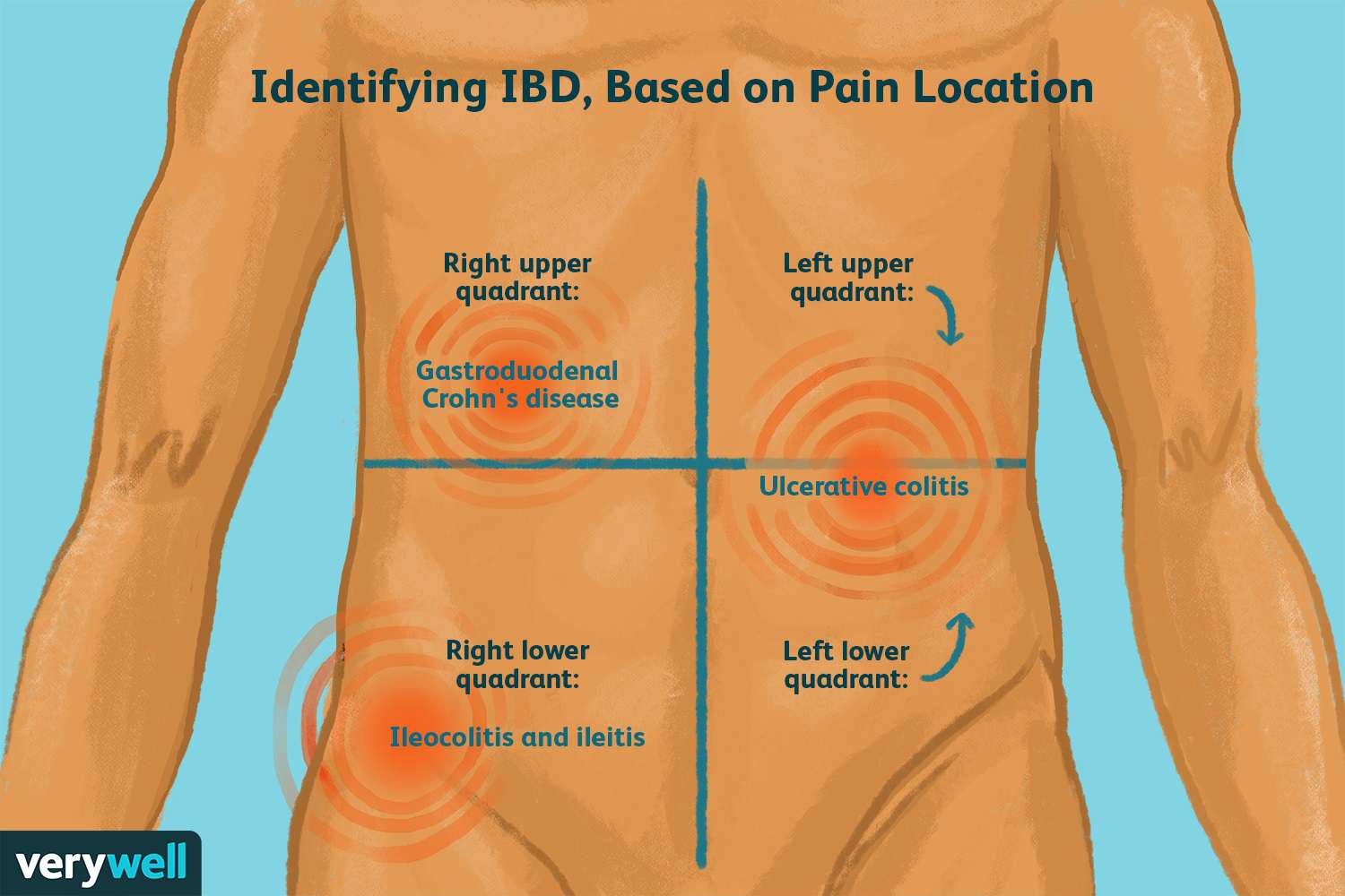 pain in right side abdomen under ribs