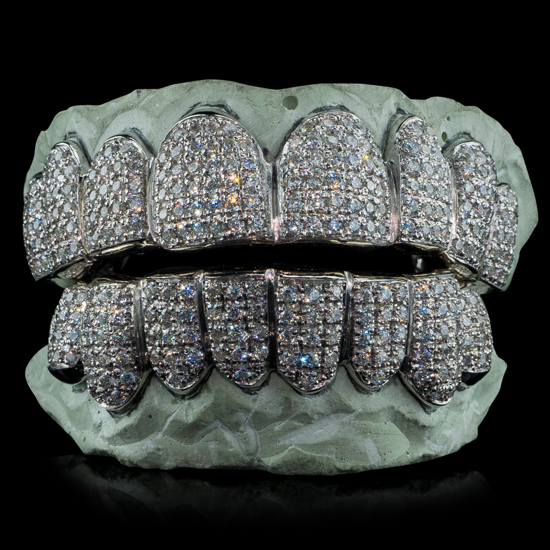 iced out grillz