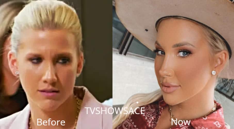 savannah chrisley nose job