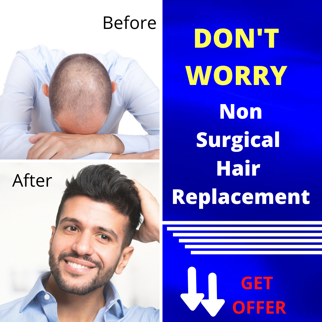 non surgical hair replacement in pune