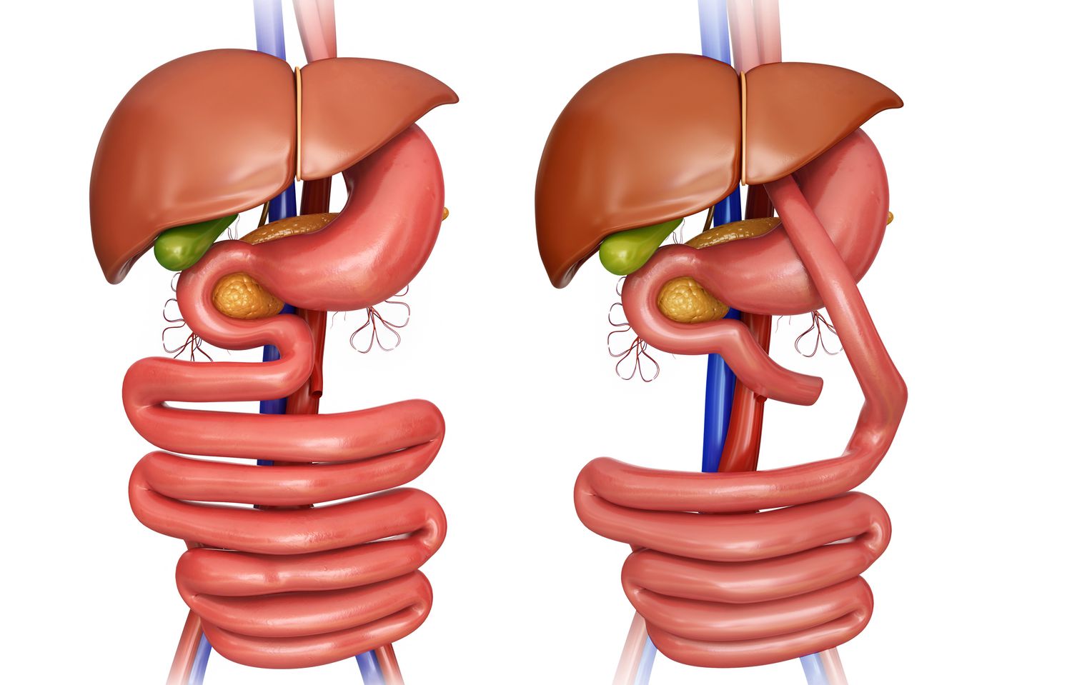 anastomosis