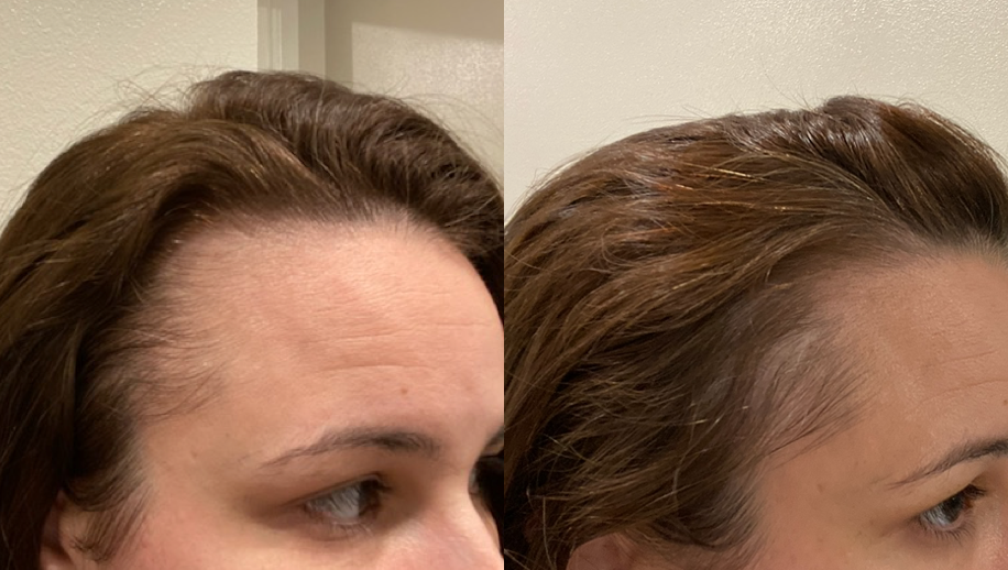 the ordinary hair serum opiniones