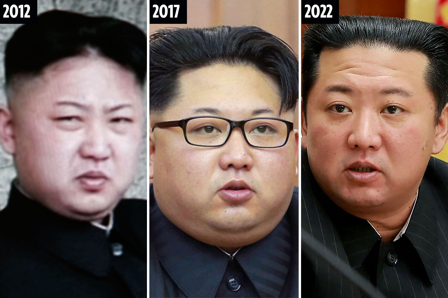 kim jong un weight loss