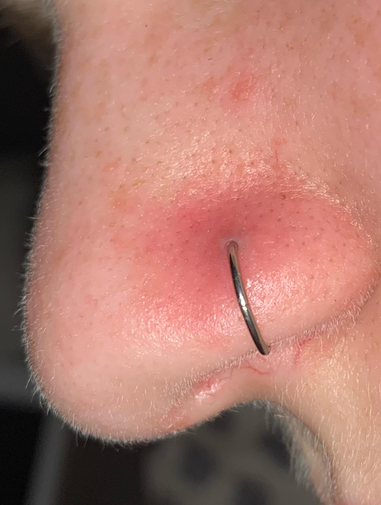 how to heal infected nose ring