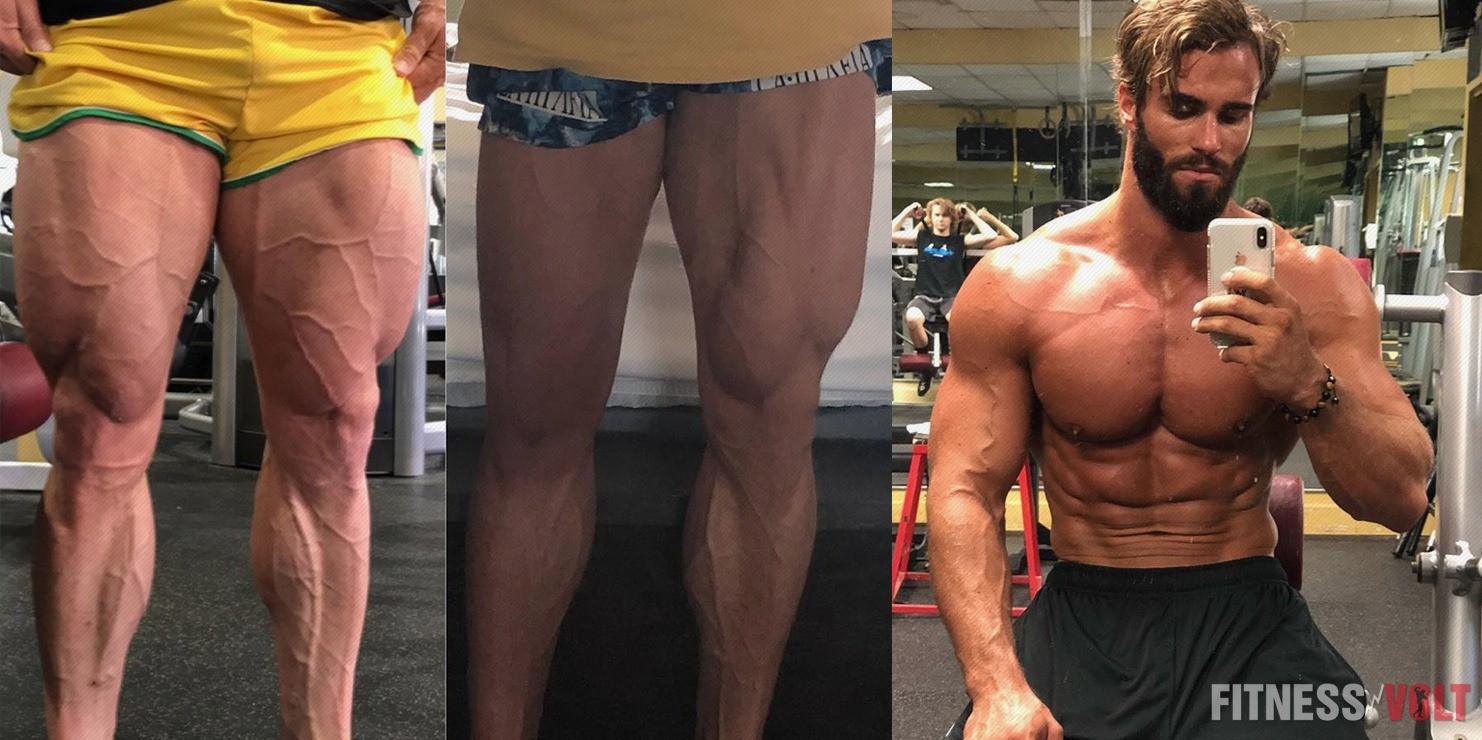 calum von moger injury