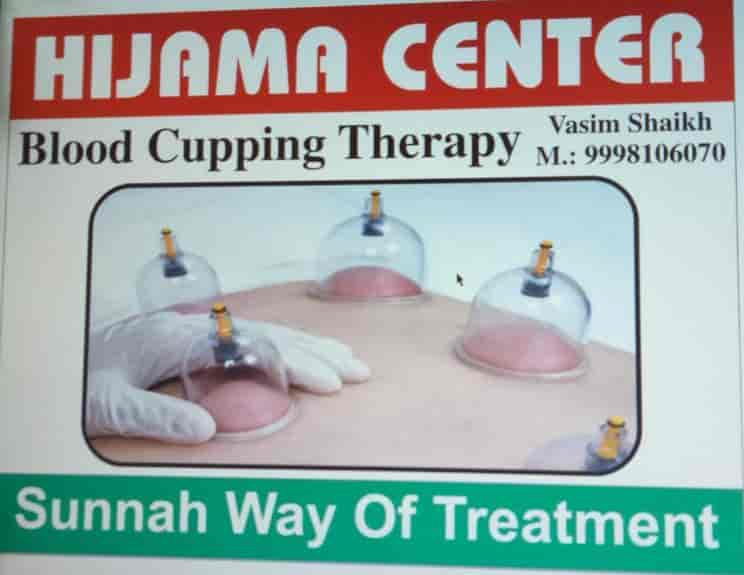 cupping therapy in ahmedabad