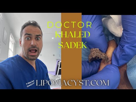 dr khaled sadek