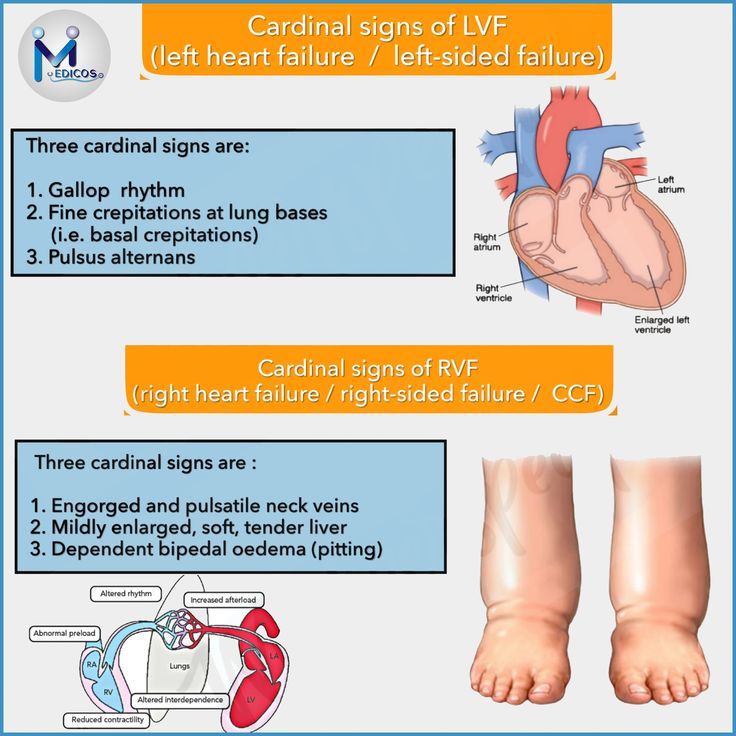 lvf medical abbreviation