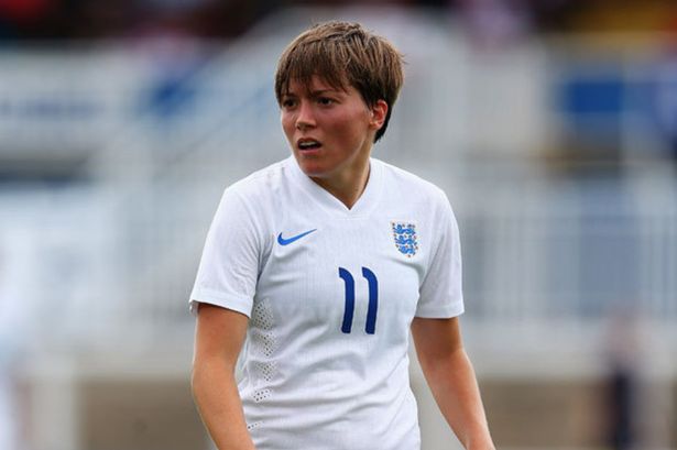 fran kirby short hair