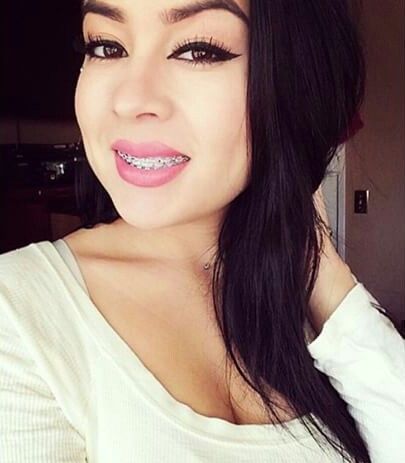 latina braces