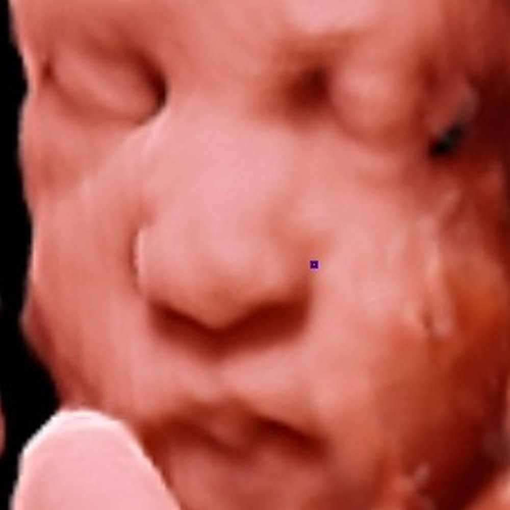 3d ultrasound brampton ontario