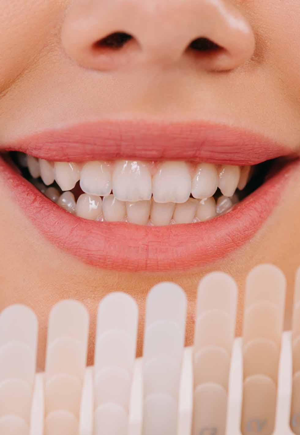 dental teeth whitening treatment maple ridge