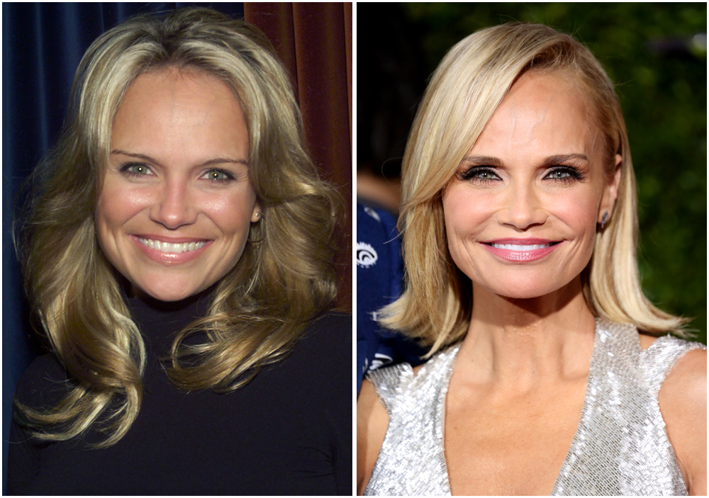 kristin chenoweth boob job