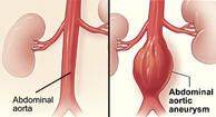 left side of stomach pulsing