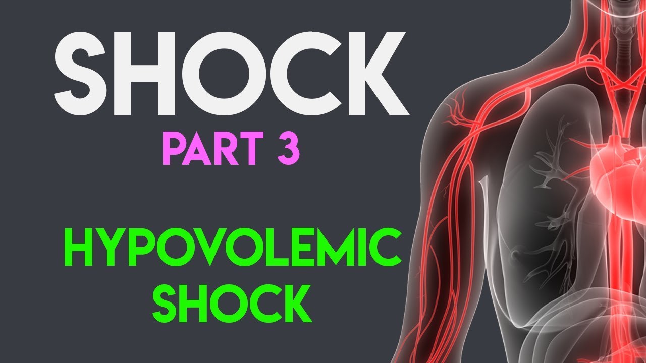 shock meaning in kannada