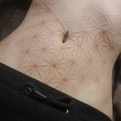 healed scarification