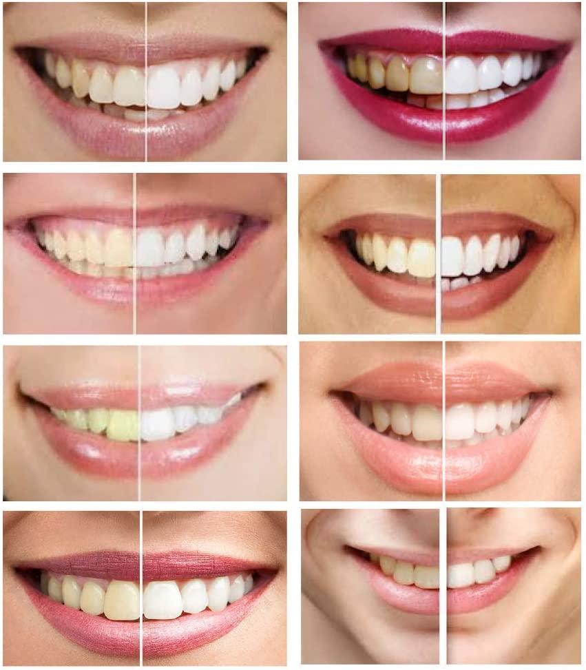 ismile teeth whitening reviews