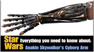 anakin mechanical arm