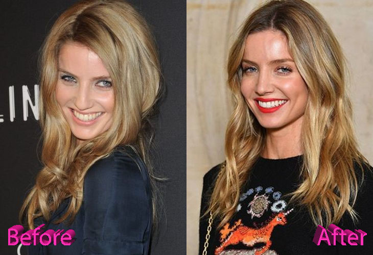 annabelle wallis nose surgery