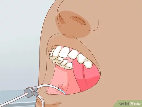 how to unclog salivary duct