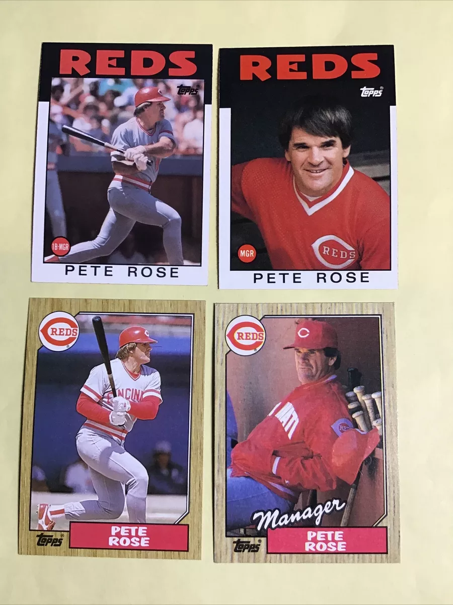 1987 topps pete rose manager