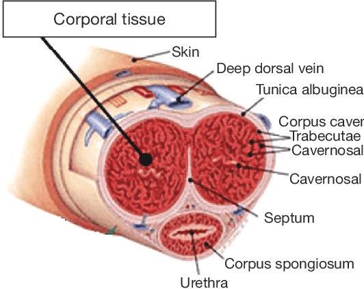 deep shaft piercing