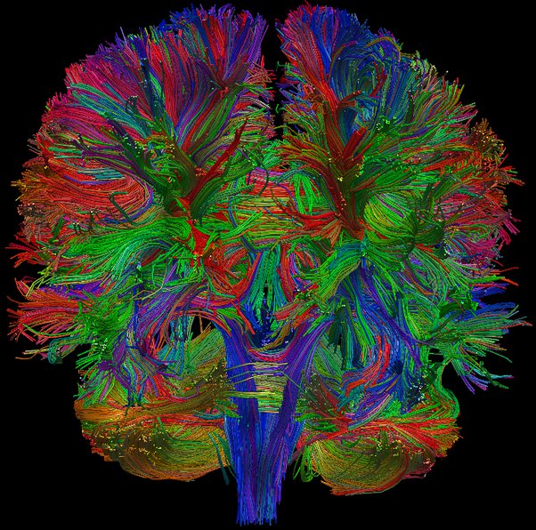 diffusion tensor imaging