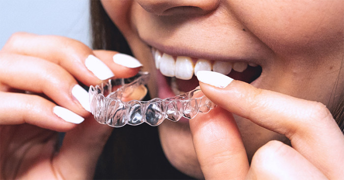 dr smile aligner