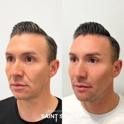 saint savant medical aesthetics