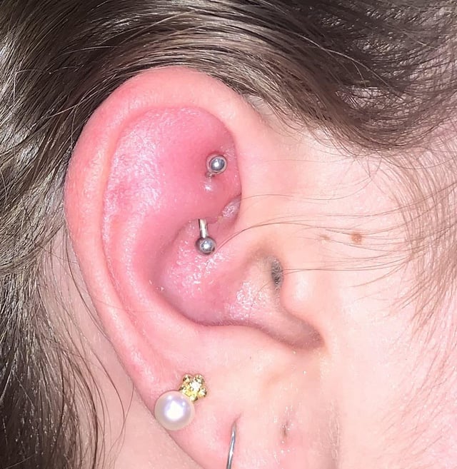 rook piercing infection