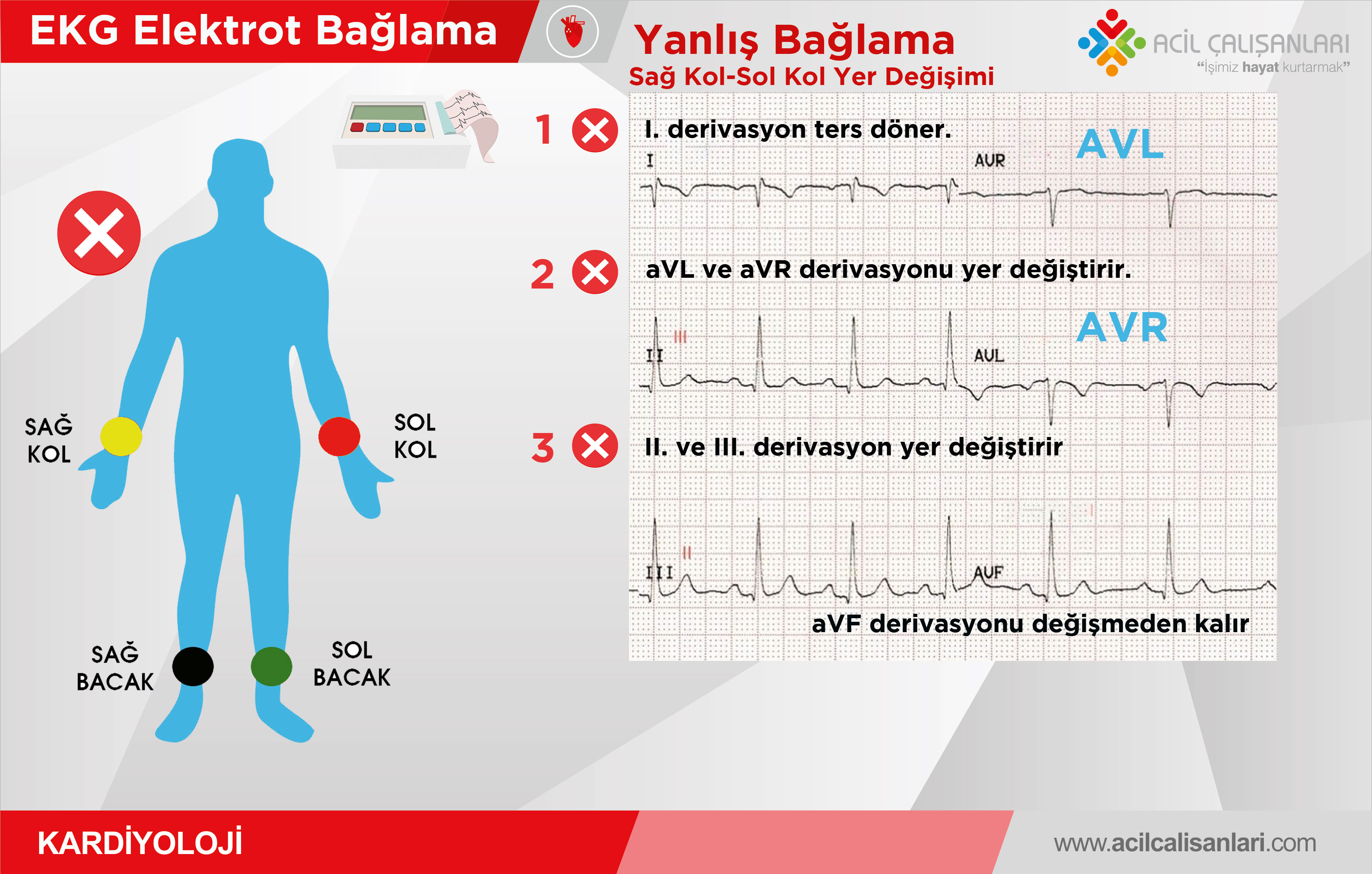 ekg bağlanması renkler