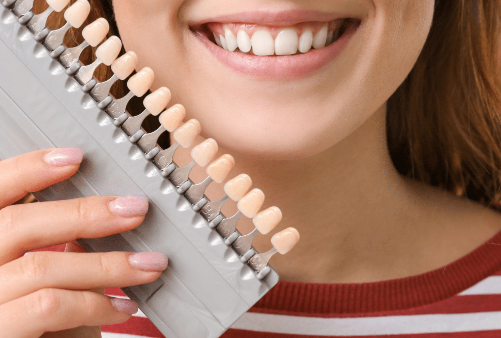 dental veneer treatment maple ridge