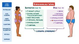 is cushing syndrome treatable