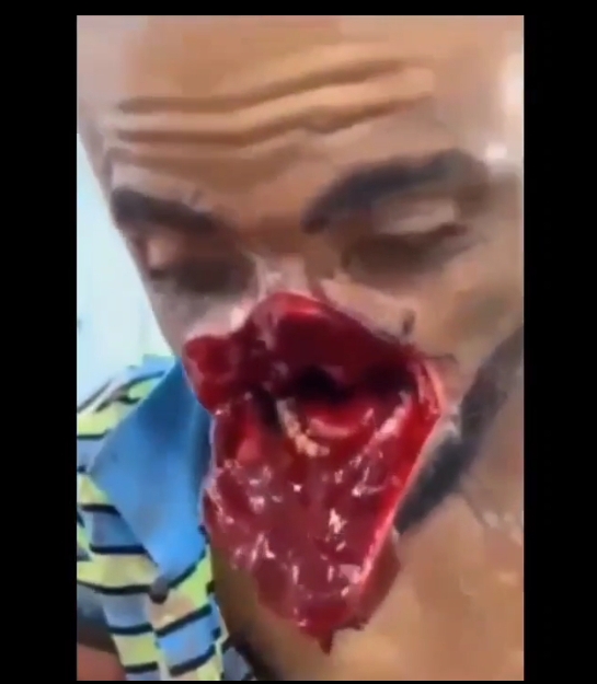 livegore