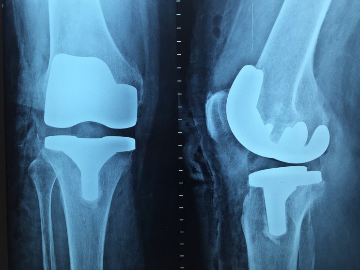 orthopedic 뜻