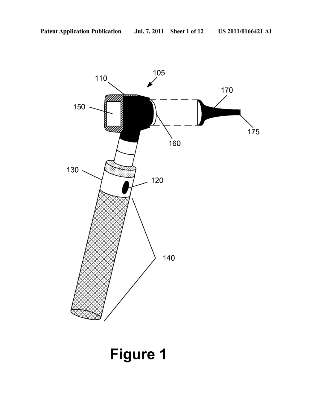 otoscope diagram