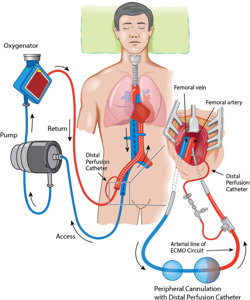 perfusionist salary new york