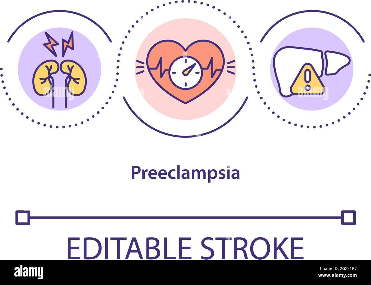 preeclampsia dibujo