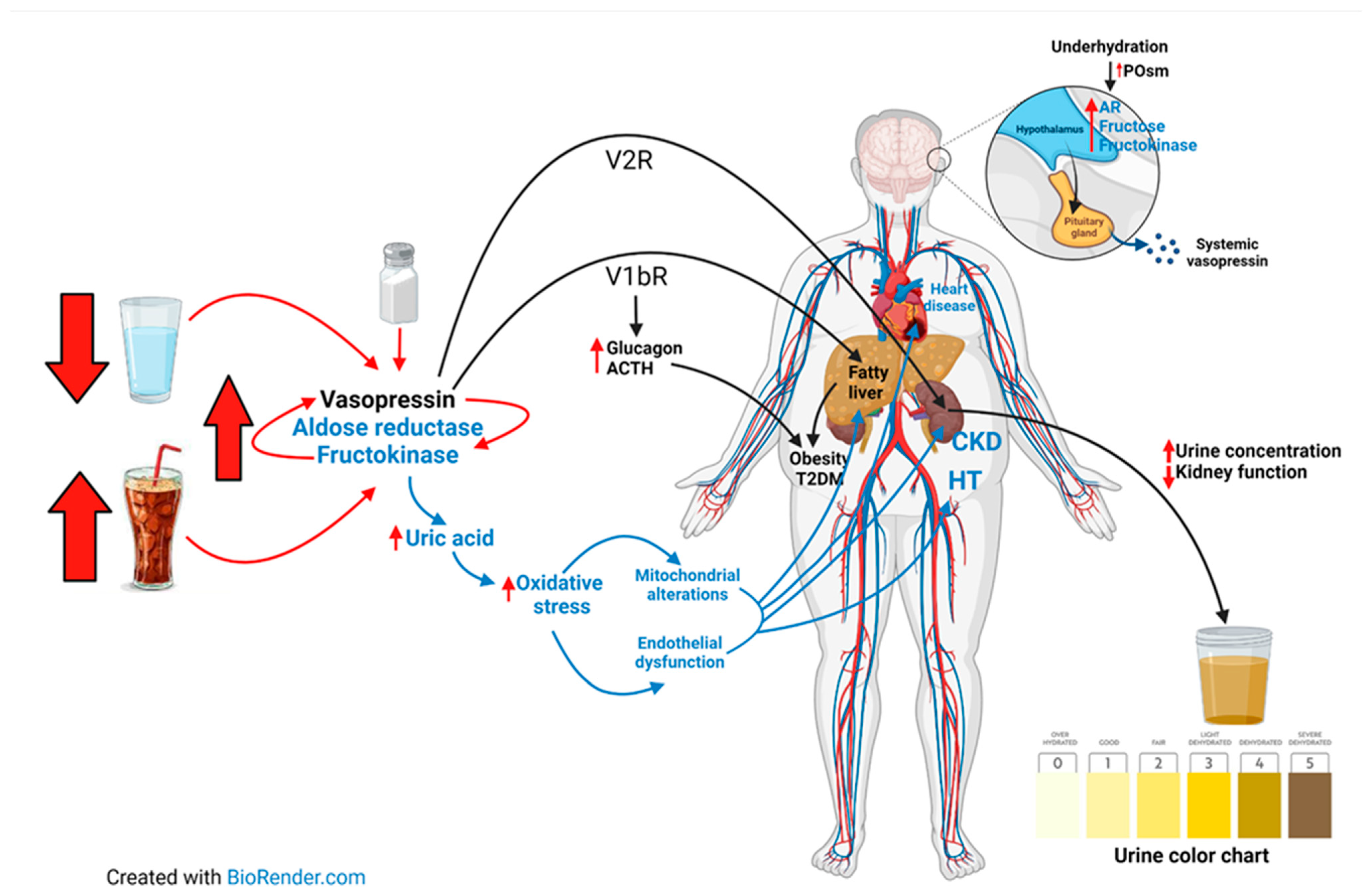 soft water contains sodium which may aggravate hypertension