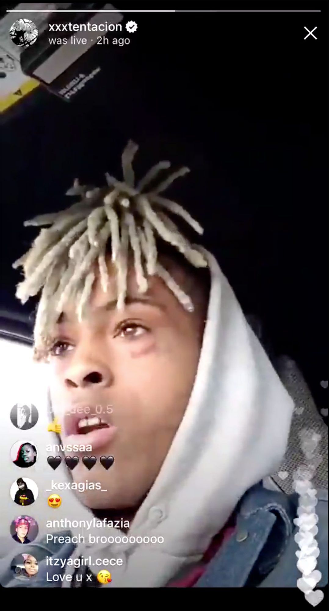 xxxtentacion faked his death